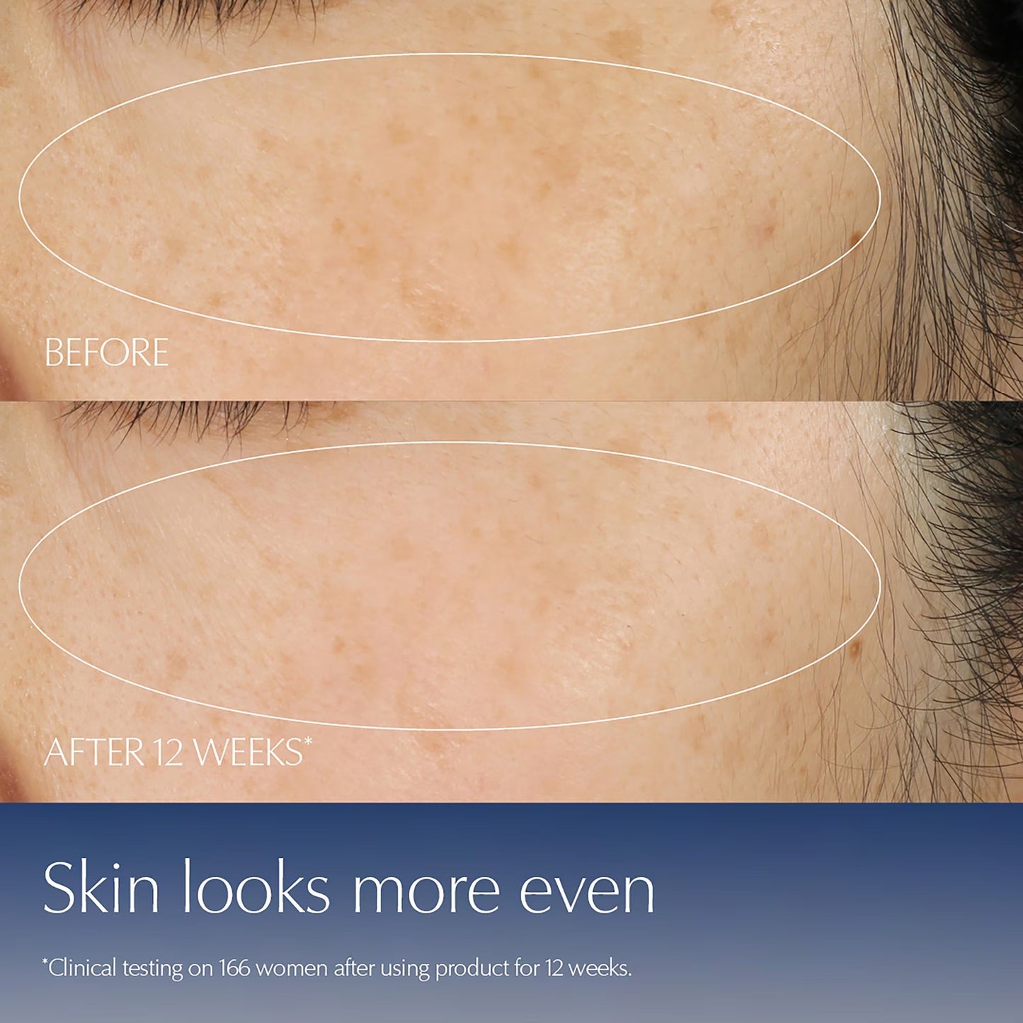 Advanced Night Repair Serum Synchronized Multi-Recovery Complex