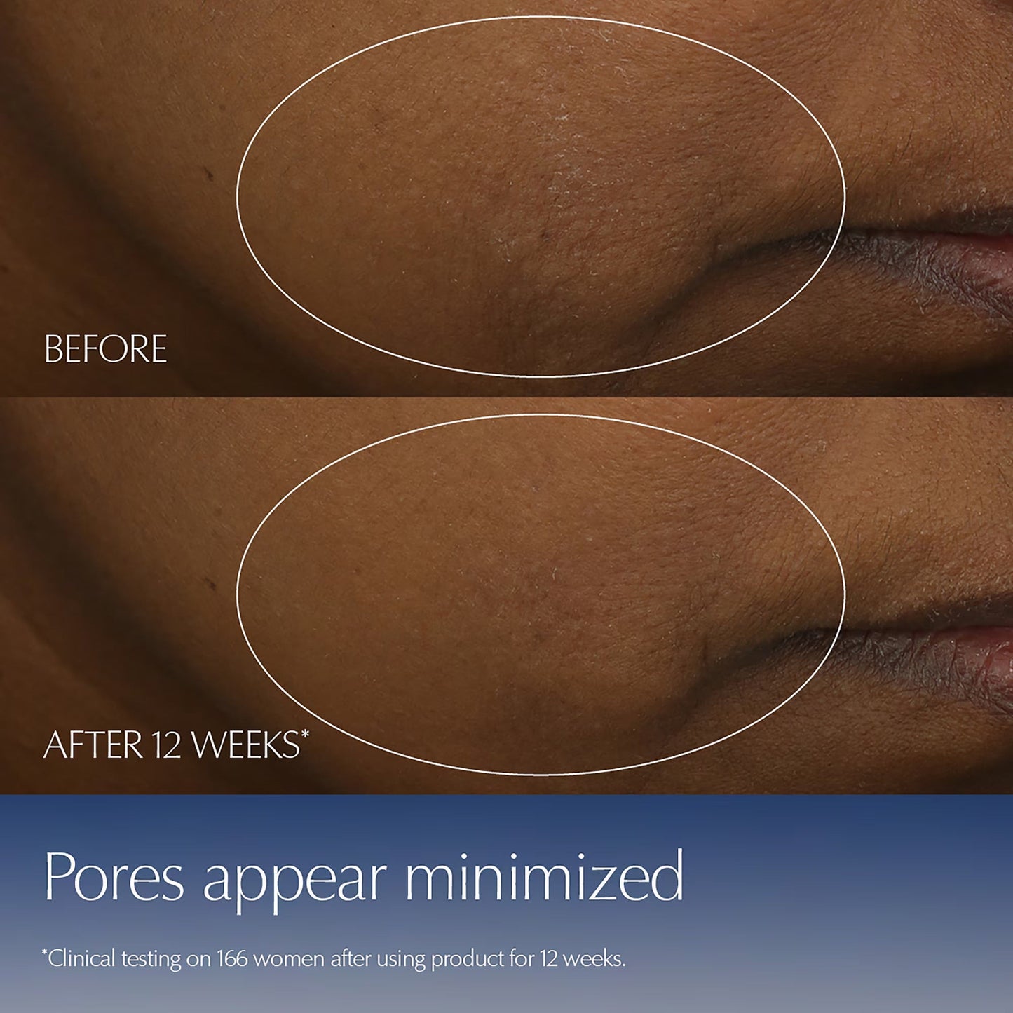 Advanced Night Repair Serum Synchronized Multi-Recovery Complex