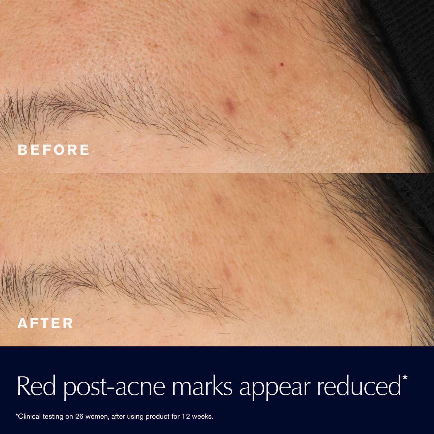 Advanced Night Repair Rescue Solution Serum with 15% Bifidus Ferment Travel size