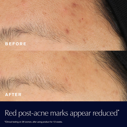 Advanced Night Repair Rescue Solution Serum with 15% Bifidus Ferment Travel size