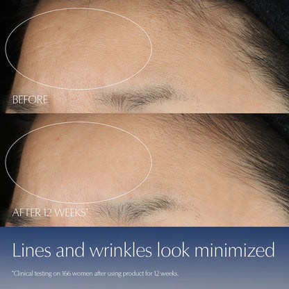 Advanced Night Repair Serum Limited Edition Bottle