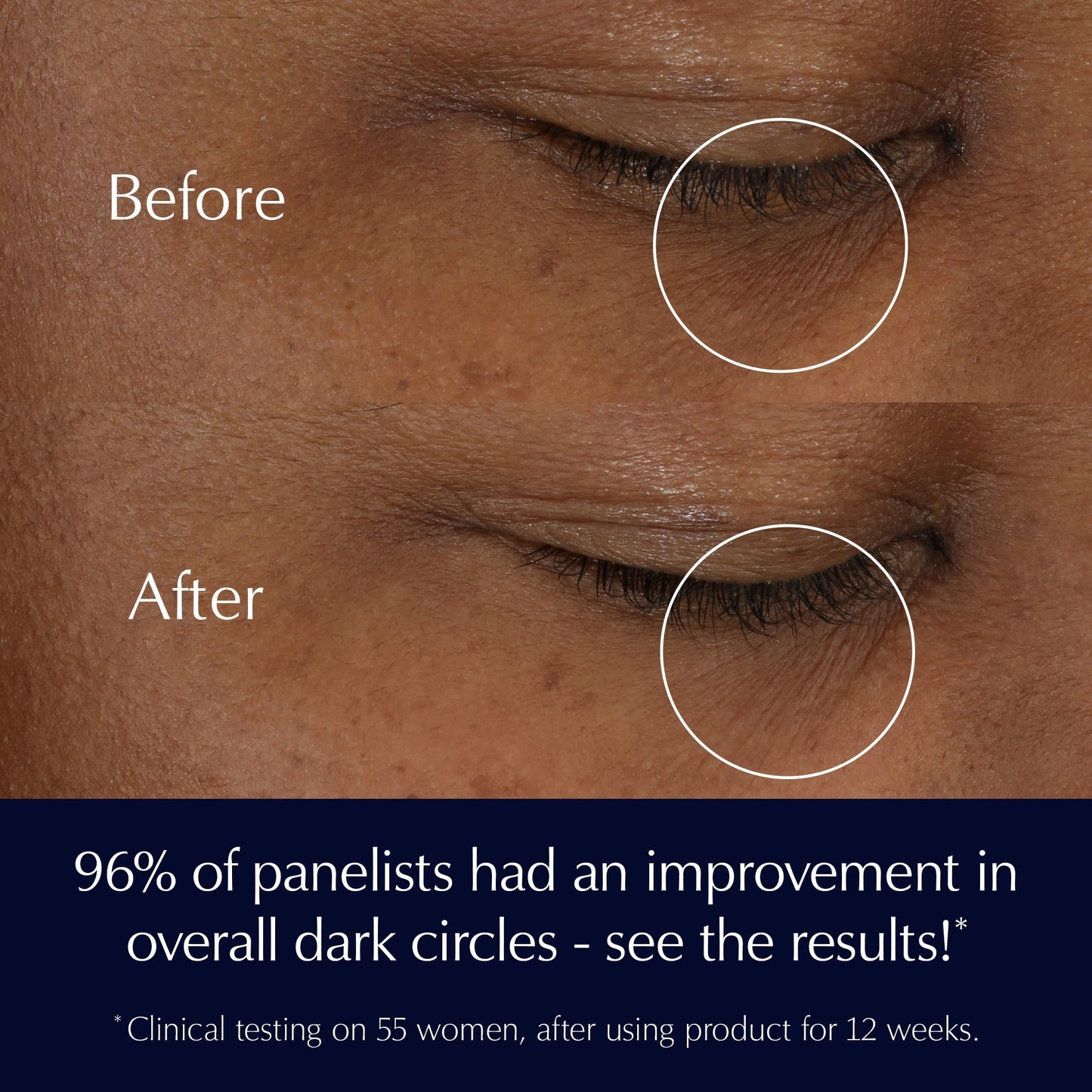 Advanced Night Repair Eye Supercharged Gel-Creme Synchronized Multi-Recovery Eye Cream